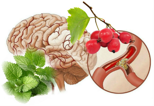 Как улучшить самочувствие при атеросклерозе головного мозга